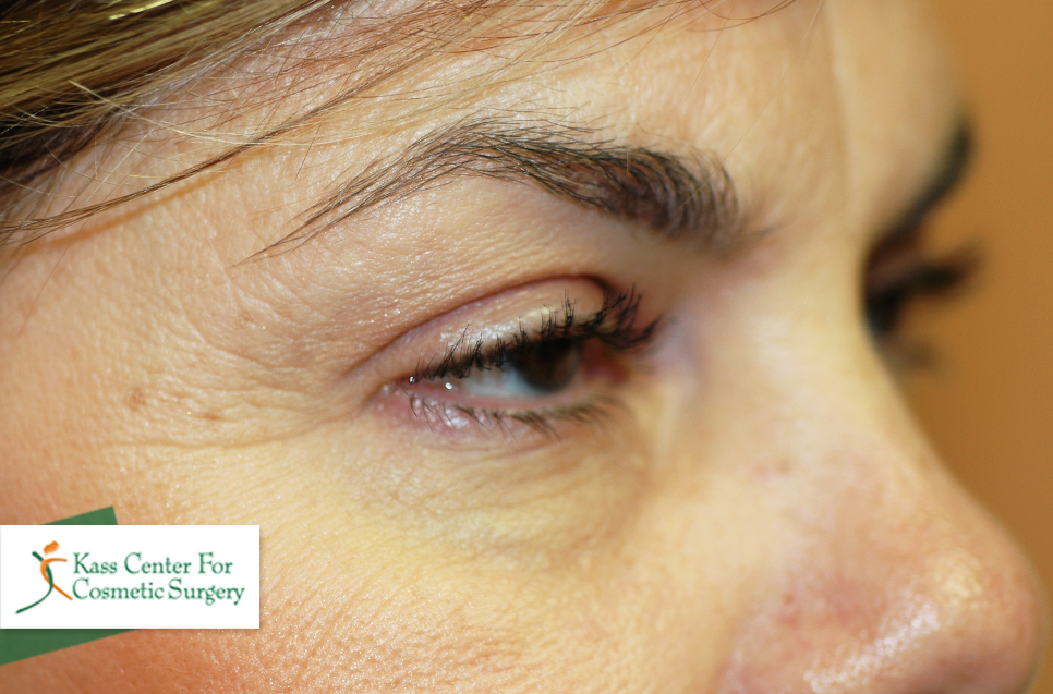 Festoons Cosmetic Surgery Gallery